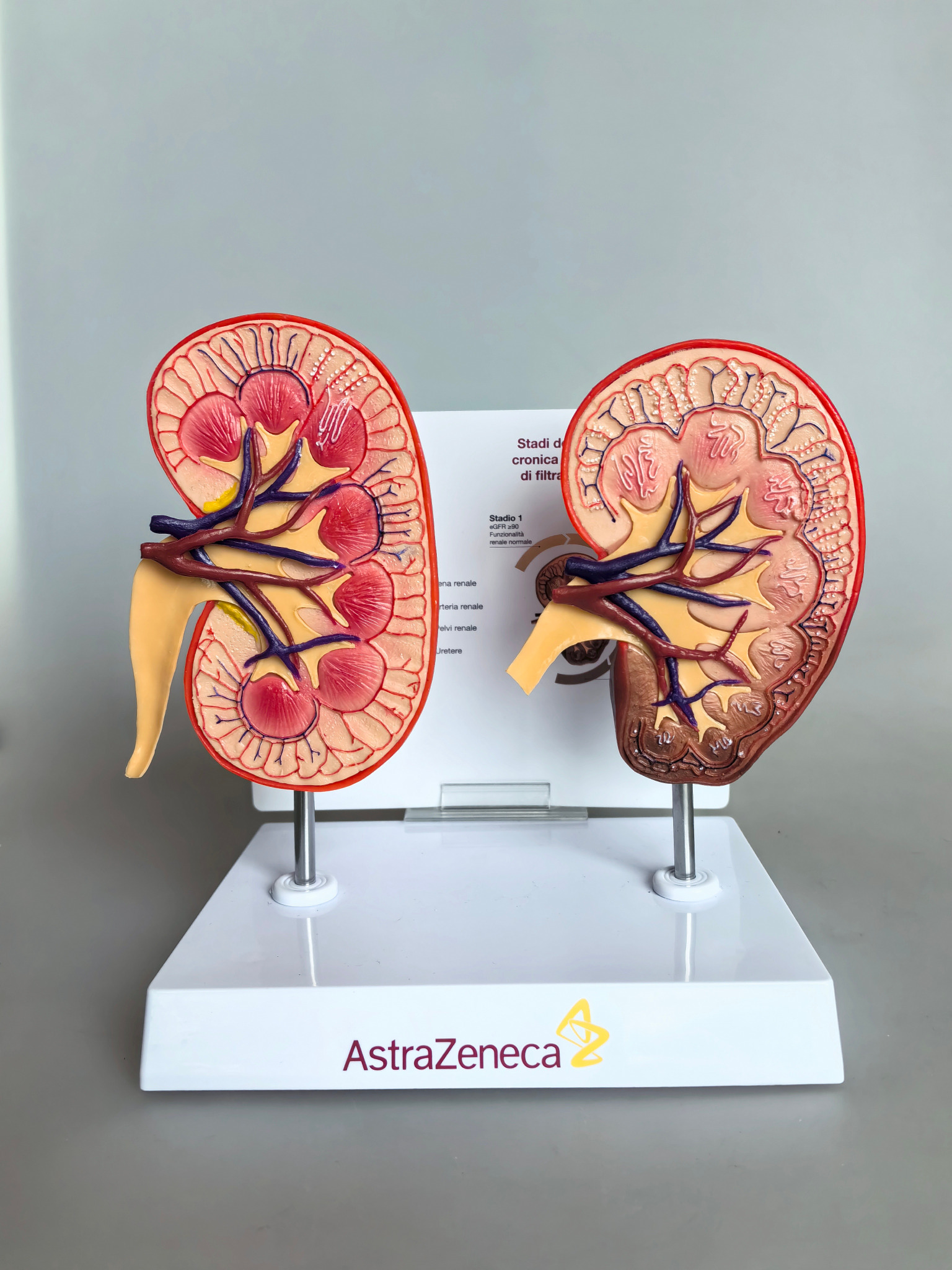 AstraZeneca Nierenmodell