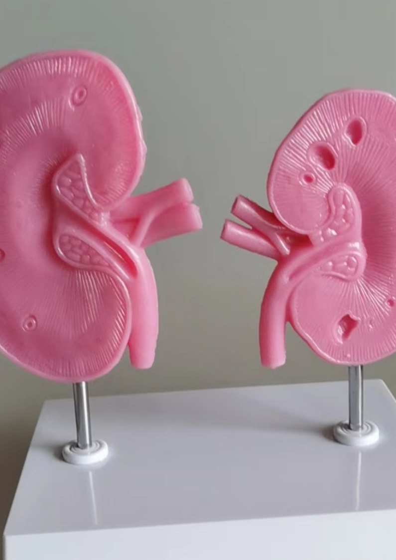 Prototyp des AstraZeneca Nierenmodells